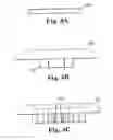 Fig. 09 - Methods and apparatus for securing a therapy delivery device within a burr hole