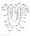 Fig. 01 - Dynamic bioabsorbable fastener for use in wound closure