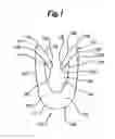 Fig. 02 - Dynamic bioabsorbable fastener for use in wound closure