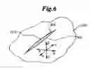 Fig. 07 - Dynamic bioabsorbable fastener for use in wound closure
