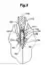 Fig. 09 - Dynamic bioabsorbable fastener for use in wound closure