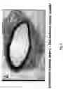 Fig. 09 - Electrical devices and anti-scarring agents