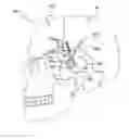 Fig. 01 - Treatment of epilepsy by high frequency electrical stimulation and/or drug stimulation