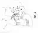 Fig. 13 - Treatment of epilepsy by high frequency electrical stimulation and/or drug stimulation