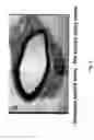 Fig. 09 - Electrical devices and anti-scarring agents