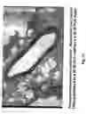 Fig. 11 - Electrical devices and anti-scarring agents
