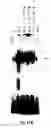 Fig. 13 - Electrical devices and anti-scarring agents