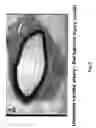 Fig. 09 - Electrical devices and anti-scarring agents