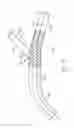 Fig. 07 - Multi-stent delivery system
