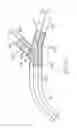 Fig. 08 - Multi-stent delivery system
