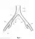Fig. 02 - Introducer for an iliac side branch device
