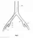 Fig. 07 - Introducer for an iliac side branch device