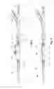 Fig. 08 - Introducer for an iliac side branch device