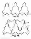Fig. 07 - Intraluminal stent and graft