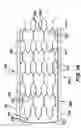 Fig. 09 - Intraluminal stent and graft