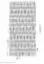 Fig. 22 - Flexible and expandable stent