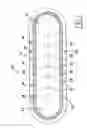 Fig. 02 - MRI imageable medical device