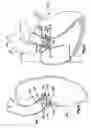 Fig. 09 - Support apparatus and heart valve prosthesis for sutureless implantation
