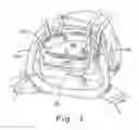 Fig. 02 - Three-dimensional annuloplasty ring and template