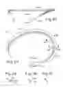 Fig. 07 - Three-dimensional annuloplasty ring and template