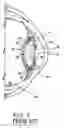 Fig. 02 - Intraocular multifocal lens