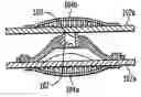 Fig. 01 - Intervertebral spacer device having a domed arch shaped spring