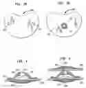 Fig. 04 - Intervertebral spacer device having a domed arch shaped spring