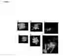Fig. 02 - Method for regenerating and transforming St. Augustinegrass from embryogenic callus
