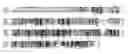 Fig. 01 - AXMI-010, a delta-endotoxin gene and methods for its use