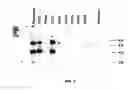 Fig. 08 - Fine mapping and application of dna markers linked to a gall midge resistance gene for marker-aided selection in rice