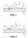 Fig. 08 - Bed blanket structure to maintain legs in a fixed position