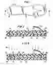 Fig. 02 - Method of fabricating custom-fitted footbed