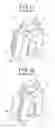 Fig. 07 - Metallic slide fastener element and method for manufacturing the same