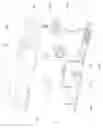 Fig. 09 - Motion-detecting note holder
