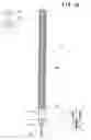 Fig. 13 - Post-construction anchor, and drill bit for drilling prepared holes therefor
