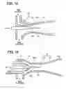 Fig. 09 - Ejector-type depressurizer for vapor compression refrigeration system