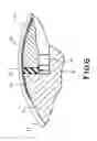 Fig. 07 - Strip planarity measuring method and apparatus