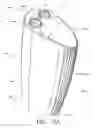 Fig. 04 - Air treatment apparatus having an electrode extending along an axis which is substantially perpendicular to an air flow path