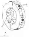 Fig. 01 - Combined ablation and exposure system and method