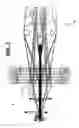Fig. 02 - Weaving machine and method for weaving pile fabrics and spacer for such a weaving machine