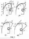 Fig. 02 - Hinge assembly