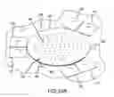 Fig. 30 - Glaucoma implant having MEMS filter module
