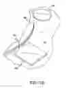Fig. 33 - Glaucoma implant having MEMS filter module