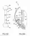 Fig. 37 - Glaucoma implant having MEMS filter module