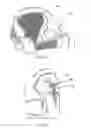 Fig. 07 - Child carrier with side buckle and venting