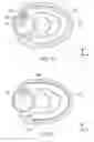 Fig. 09 - Method and apparatus for performing catheter-based annuloplasty using local plications
