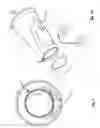 Fig. 04 - Bullhorn cup