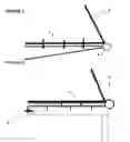 Fig. 02 - Canopy lift system