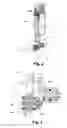 Fig. 04 - Projection lens fixation and adjustment mechanism