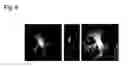 Fig. 07 - Method of full-color optical coherence tomography